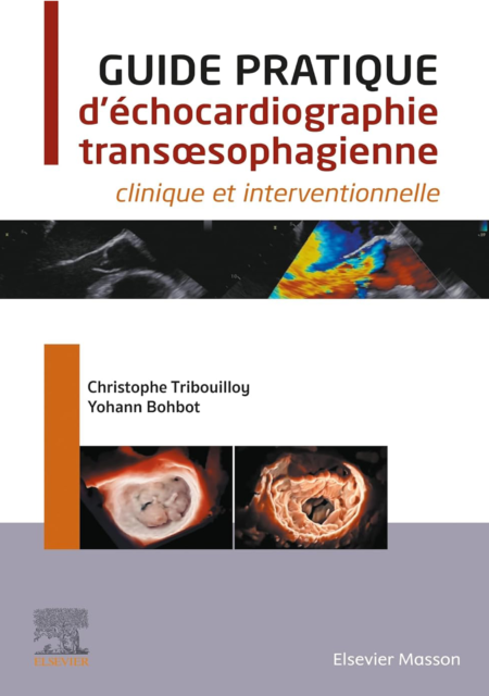 Guide pratique d'échocardiographie Trans-œsophagienne